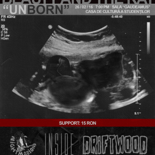 Beauty and the Rat – Lansare album „Unborn” (2016)