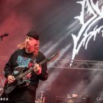 Dying Fetus